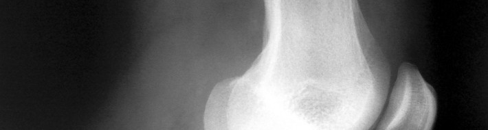 knee xray side view